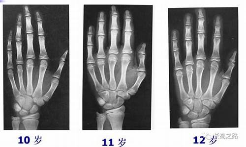 骨龄运动员_国家队骨龄的要求